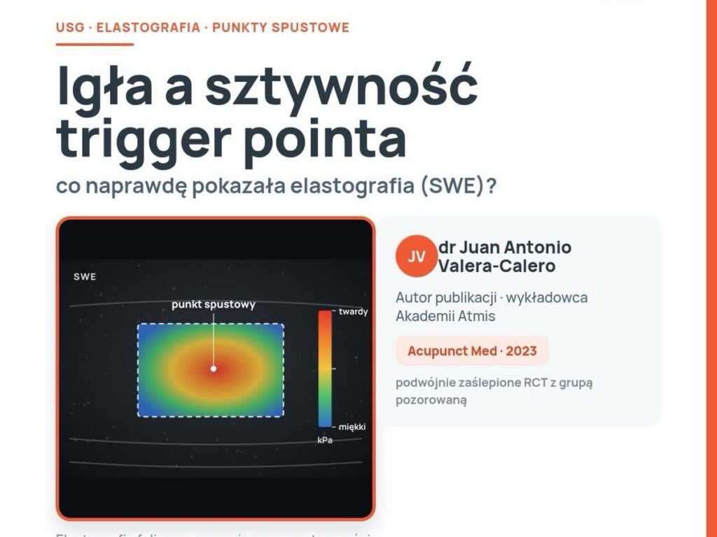 Jak naprawdę działa suche igłowanie?