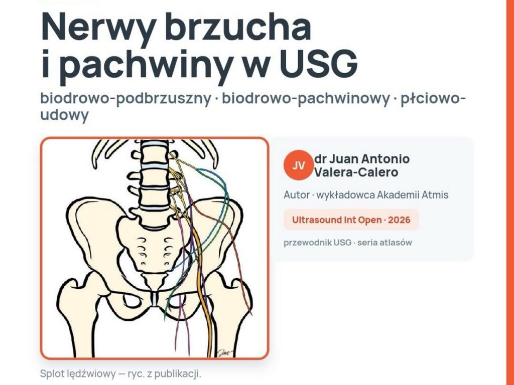 Atlas USG nerwów splotu lędźwiowego